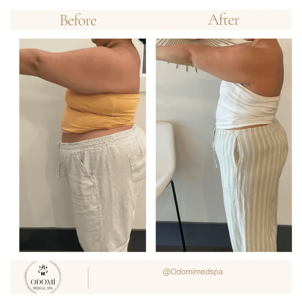Medical Weight Loss in Savannah, GA