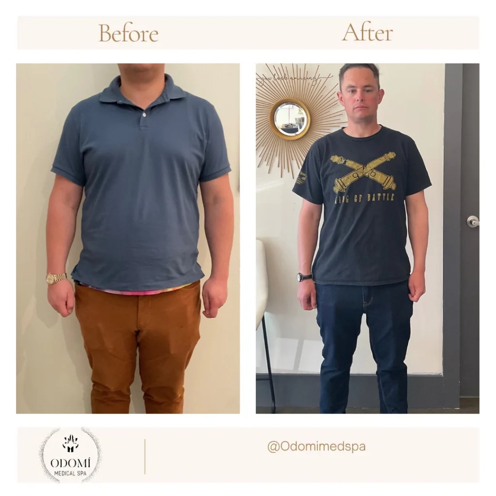 Before & after Medical Weight Loss in Savannah, GA