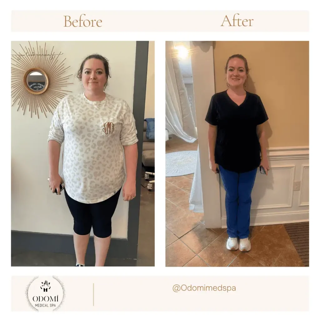 Before and after Medical Weight Loss in Savannah, GA
