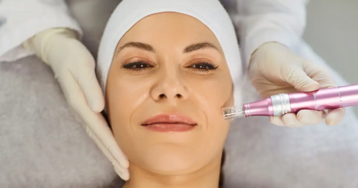 Women Receiving Microneedling in Savannah, GA