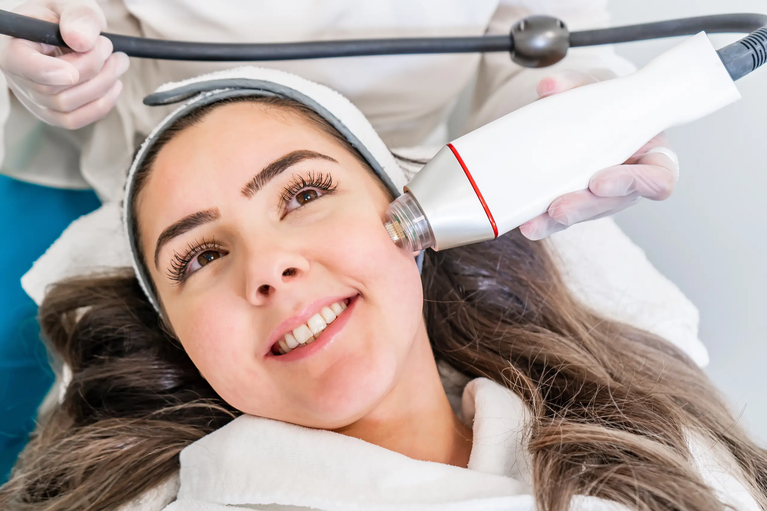 RF Microneedling in Savannah, GA