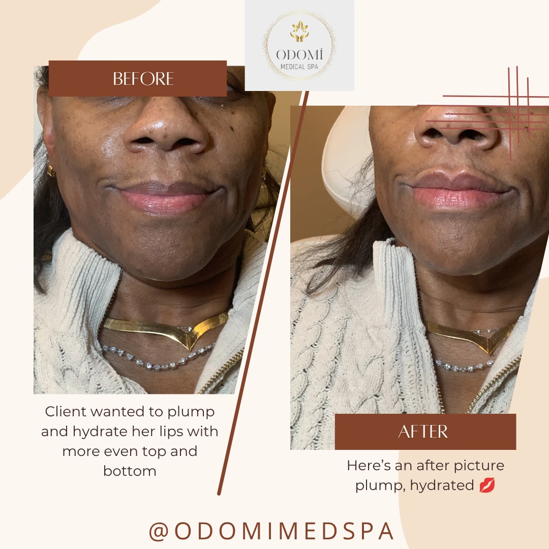 Before-After2