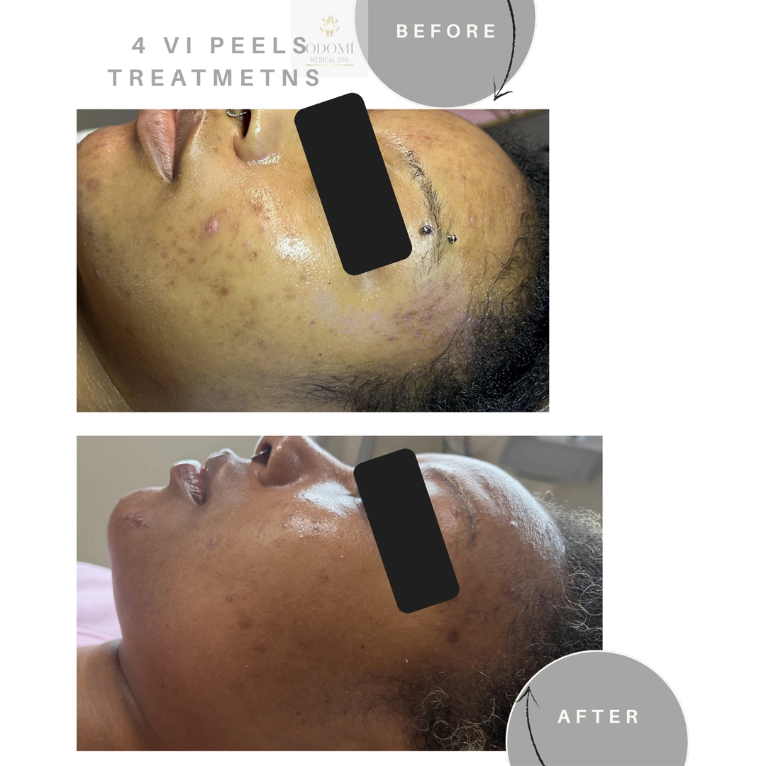 Before-After3