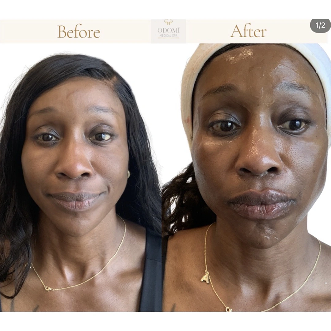 Before-After4