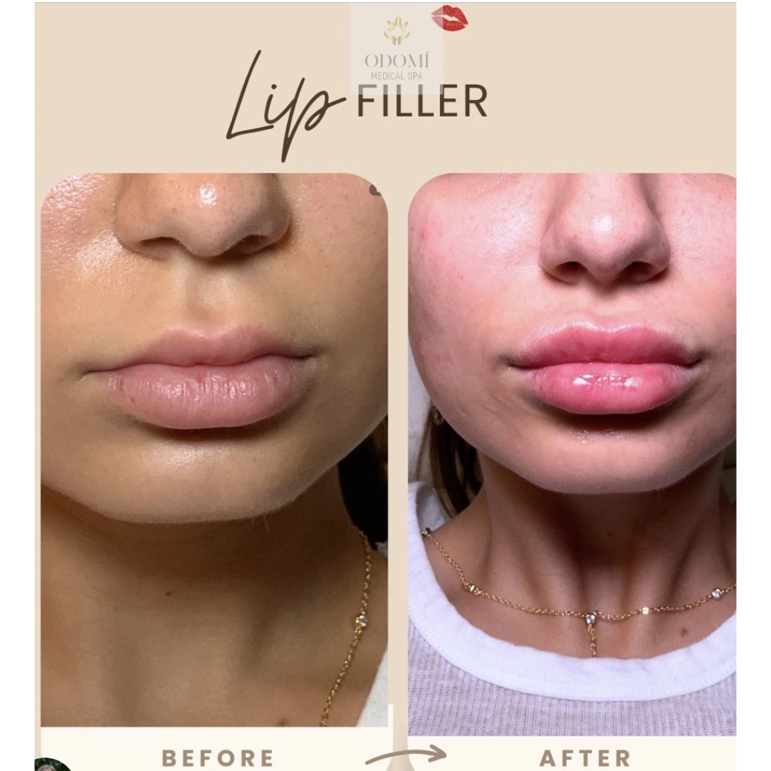 Before-After5