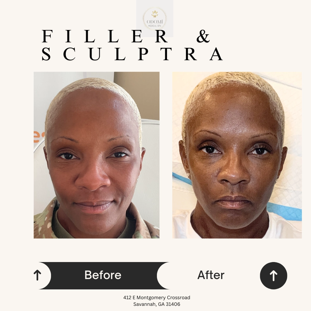 Before-After7