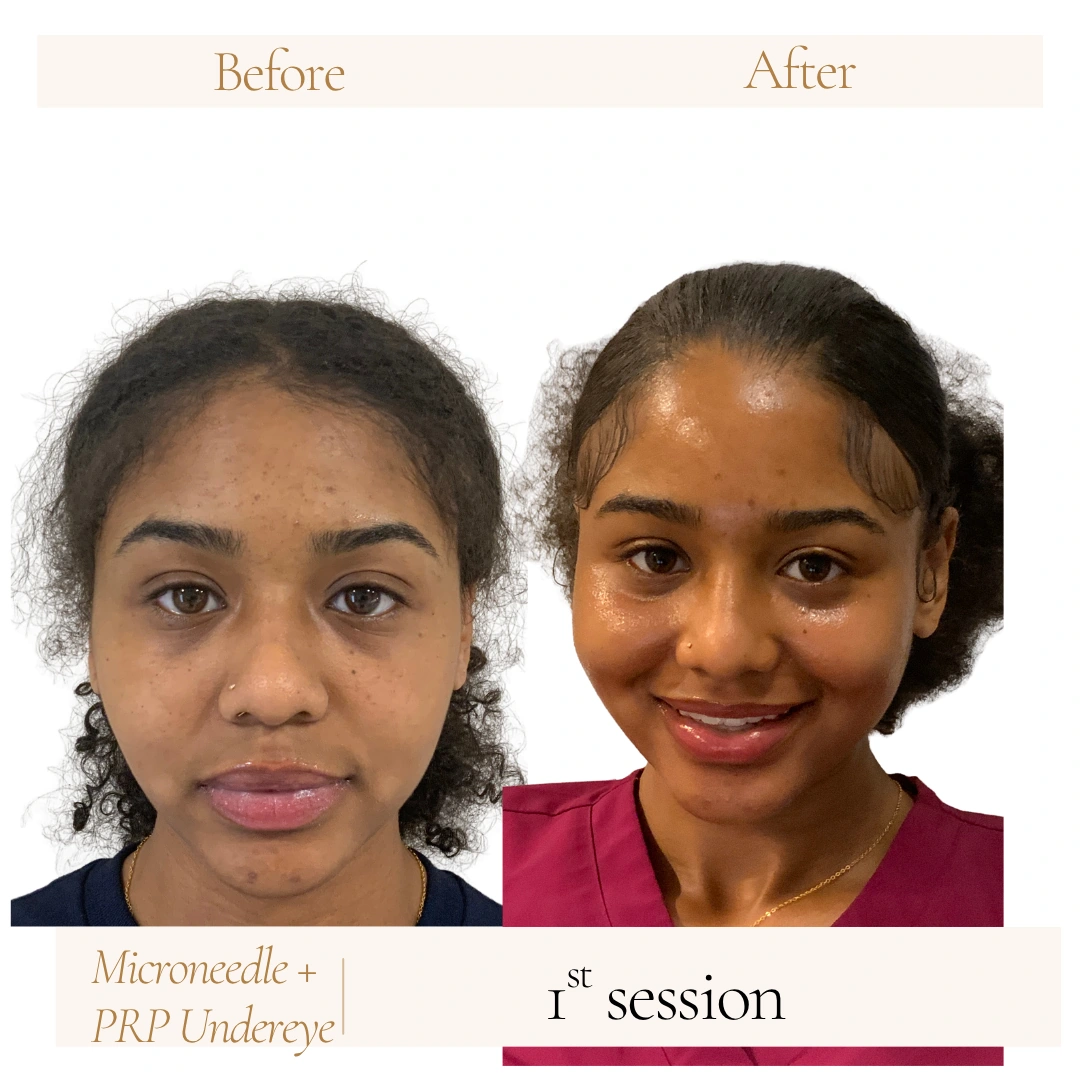 Before-After8